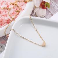uploads/erp/collection/images/Fashion Jewelry/zuowen/XU0515497/img_b/XU0515497_img_b_1